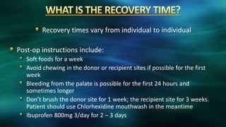 Recovery times vary from individual to individual
Post-op instructions include:
Soft foods for a week
Avoid chewing in the donor or recipient sites if possible for the first
week
Bleeding from the palate is possible for the first 24 hours and
sometimes longer
Don’t brush the donor site for 1 week; the recipient site for 3 weeks.
Patient should use Chlorhexidine mouthwash in the meantime
Ibuprofen 800mg 3/day for 2 – 3 days
 