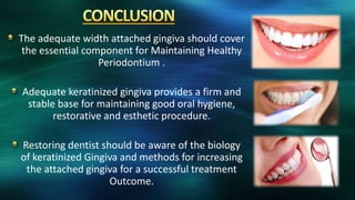 The adequate width attached gingiva should cover
the essential component for Maintaining Healthy
Periodontium .
Adequate keratinized gingiva provides a firm and
stable base for maintaining good oral hygiene,
restorative and esthetic procedure.
Restoring dentist should be aware of the biology
of keratinized Gingiva and methods for increasing
the attached gingiva for a successful treatment
Outcome.
 