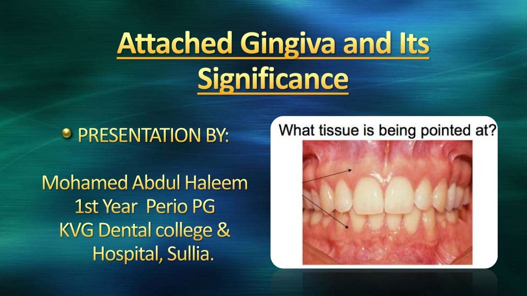 Attached gingiva and its significance