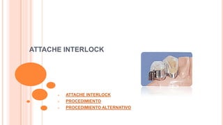 ATTACHE INTERLOCK



ATTACHE INTERLOCK



PROCEDIMIENTO



PROCEDIMIENTO ALTERNATIVO

 