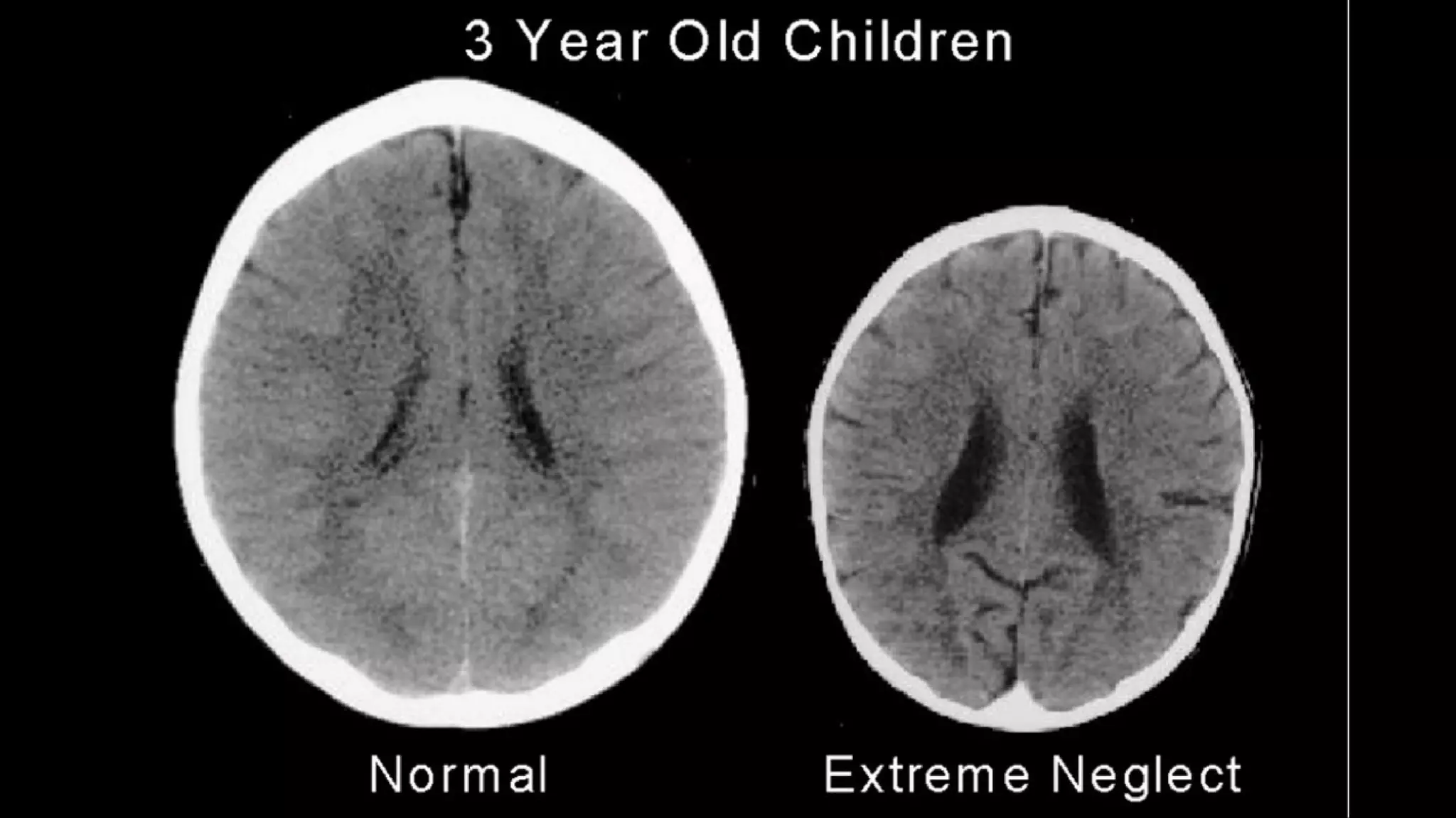 Attachment Theory In Practice