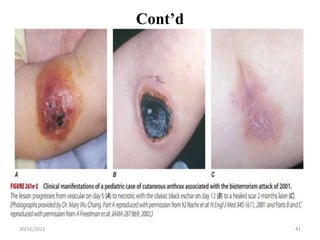 Cont’d
30/11/2023 41
 