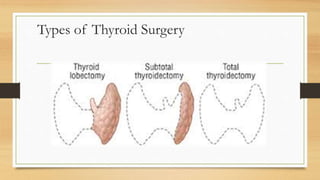 Types of Thyroid Surgery
 