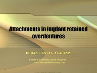 Attachments in implant retained
overdentures
INDIAN DENTAL ACADEMY
Leader in continuing dental education
www.indiandentalacademy.com
www.indiandentalacademy.com
 