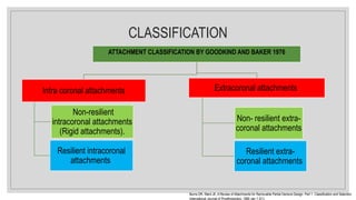 CLASSIFICATION
ATTACHMENT CLASSIFICATION BY GOODKIND AND BAKER 1976
Intra coronal attachments
Resilient intracoronal
attachments
Non-resilient
intracoronal attachments
(Rigid attachments).
Extracoronal attachments
Non- resilient extra-
coronal attachments
Resilient extra-
coronal attachments
Burns DR, Ward JE. A Review of Attachments for Removable Partial Denture Design: Part 1. Classification and Selection.
International Journal of Prosthodontics. 1990 Jan 1;3(1).
 