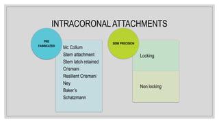 INTRACORONAL ATTACHMENTS
Mc Collum
Stern attachment
Stern latch retained
Crismani
ResIlient Crismani
Ney
Baker’s
Schatzmann
PRE
FABRICATED
Locking
Non locking
SEMI PRECISION
 