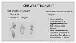CRISMANI ATTACHMENT
RIGID CRISMANI ATTACHMENT
 Frictional grip
 Mechanical  Spring clip
Precision attachments – a link to successful restorative treatment Gareth Jenkins Quint Publishing
RESILIENT CRISMANI ATTACHMENT
Two types
1) Allowing pure hinge
movement- used as a
hinged stress breaker in
distal extension partial
dentures.
2) Vertical stress breakers
some allows combination of
both actions along with some
amount of lateral movement
 