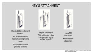 NEY’S ATTACHMENT
Ney’s MS
attachment
Minimal space
attachment
Standard (Conventional H
shaped)
No. 6 –bicuspids and
molars.medium proximal
contact
No.9- anteriors- small
proximal contacts
Ney loc split lingual
Wide reinforcing plate
For use in the lingual
surface of pontic
Kanathila H, Doddamani MH, Pangi A. An insight into various attachments
used in prosthodontics: A review.
 