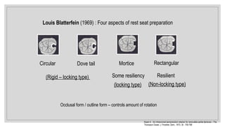 Louis Blatterfein (1969) : Four aspects of rest seat preparation
Circular Dove tail Rectangular
Mortice
(Rigid – locking type) Resilient
Some resiliency
(locking type) (Non-locking type)
Occlusal form / outline form – controls amount of rotation
Koper A. : An intracoronal semiprecision retainer for removable partial dentures – The
Thompson Dowel. J. Prosthet. Dent., 1973; 30 : 759-768
 