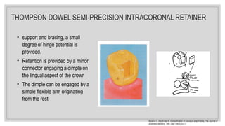 THOMPSON DOWEL SEMI-PRECISION INTRACORONAL RETAINER
Becerra G, MacEntee M. A classification of precision attachments. The Journal of
prosthetic dentistry. 1987 Sep 1;58(3):322-7.
• support and bracing, a small
degree of hinge potential is
provided.
• Retention is provided by a minor
connector engaging a dimple on
the lingual aspect of the crown
• The dimple can be engaged by a
simple flexible arm originating
from the rest
 