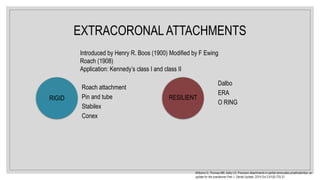 EXTRACORONAL ATTACHMENTS
Roach attachment
Pin and tube
Stabilex
Conex
RIGID
Dalbo
ERA
O RING
RESILIENT
Introduced by Henry R. Boos (1900) Modified by F Ewing
Roach (1908)
Application: Kennedy’s class I and class II
Williams G, Thomas MB, Addy LD. Precision attachments in partial removable prosthodontics: an
update for the practitioner Part 1. Dental Update. 2014 Oct 2;41(8):725-31.
 