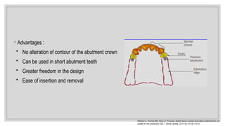 ◦ Advantages :
• No alteration of contour of the abutment crown
• Can be used in short abutment teeth
• Greater freedom in the design
• Ease of insertion and removal
Williams G, Thomas MB, Addy LD. Precision attachments in partial removable prosthodontics: an
update for the practitioner Part 1. Dental Update. 2014 Oct 2;41(8):725-31.
 