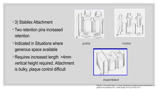 ◦ 3) Stabilex Attachment
◦ Two retention pins increased
retention
◦ Indicated in Situations where
generous space available
◦ Requires increased length >4mm
vertical height required, Attachment
is bulky, plaque control difficult
patrix matrix
Assembled
Williams G, Thomas MB, Addy LD. Precision attachments in partial removable prosthodontics: an
update for the practitioner Part 1. Dental Update. 2014 Oct 2;41(8):725-31.
 