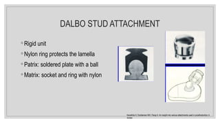 DALBO STUD ATTACHMENT
◦ Rigid unit
◦ Nylon ring protects the lamella
◦ Patrix: soldered plate with a ball
◦ Matrix: socket and ring with nylon
Kanathila H, Doddamani MH, Pangi A. An insight into various attachments used in prosthodontics: A
review.
 