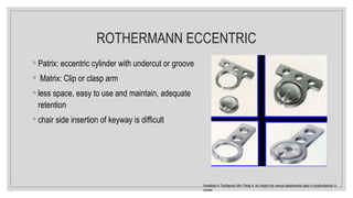ROTHERMANN ECCENTRIC
◦ Patrix: eccentric cylinder with undercut or groove
◦ Matrix: Clip or clasp arm
◦ less space, easy to use and maintain, adequate
retention
◦ chair side insertion of keyway is difficult
Kanathila H, Doddamani MH, Pangi A. An insight into various attachments used in prosthodontics: A
review.
 