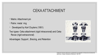 CEKAATTACHMENT
◦ Matrix: Attachment pin
◦ Patrix: metal ring
◦ Developed by Karl Cluytens (1951)
Two types- Ceka attachment (rigid intracoronal) and Ceka
Revax (rigid extracoronal)
Advantages: Support , Bracing, and Retention
Preiskel HW. Precision attachments in prosthodontics: the application of intracoronal and extracoronal
attachments. Chicago: Quintessence Publishing Co, 1984:192-7
 