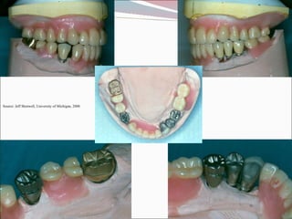 Source: Jeff Shotwell, University of Michigan, 2008 