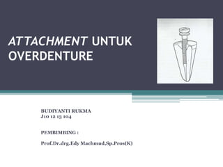 ATTACHMENT UNTUK
OVERDENTURE
BUDIYANTI RUKMA
J10 12 13 104
PEMBIMBING :
Prof.Dr.drg.Edy Machmud,Sp.Pros(K)
 