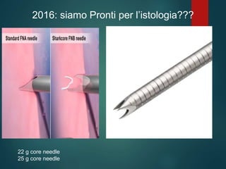 2016: siamo Pronti per l’istologia???
22 g core needle
25 g core needle
 