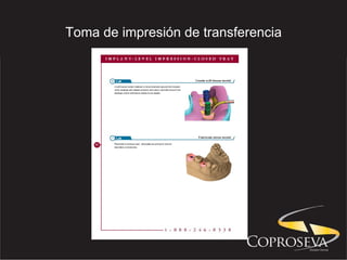 Toma de impresión de transferencia 