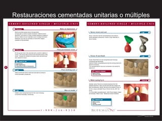 Restauraciones cementadas unitarias o múltiples 