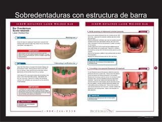 Sobredentaduras con estructura de barra 