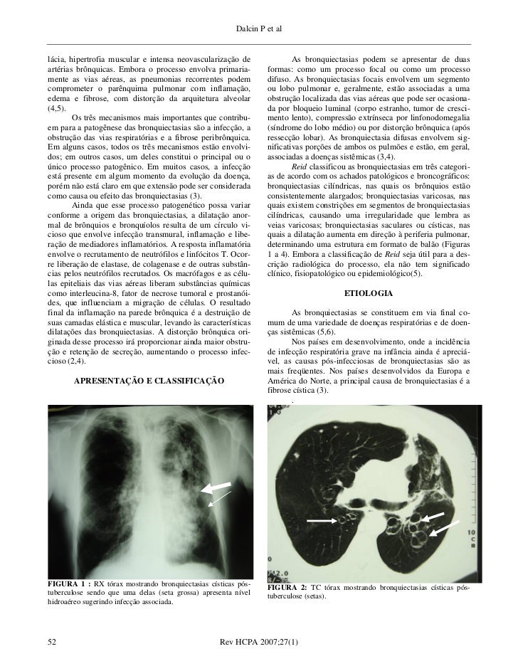 Artigos de revisao medicina