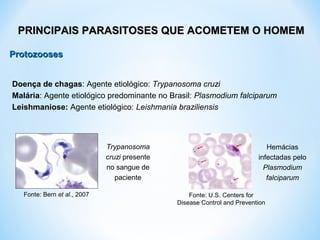 ProtozoosesProtozooses
PRINCIPAIS PARASITOSES QUE ACOMETEM O HOMEMPRINCIPAIS PARASITOSES QUE ACOMETEM O HOMEM
Doença de chagas: Agente etiológico: Trypanosoma cruzi
Malária: Agente etiológico predominante no Brasil: Plasmodium falciparum
Leishmaniose: Agente etiológico: Leishmania braziliensis
Hemácias
infectadas pelo
Plasmodium
falciparum
Fonte: U.S. Centers for
Disease Control and Prevention
Trypanosoma
cruzi presente
no sangue de
paciente
Fonte: Bern et al., 2007
 