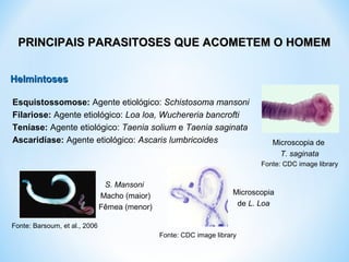 HelmintosesHelmintoses
PRINCIPAIS PARASITOSES QUE ACOMETEM O HOMEMPRINCIPAIS PARASITOSES QUE ACOMETEM O HOMEM
Esquistossomose: Agente etiológico: Schistosoma mansoni
Filariose: Agente etiológico: Loa loa, Wuchereria bancrofti
Teníase: Agente etiológico: Taenia solium e Taenia saginata
Ascaridíase: Agente etiológico: Ascaris lumbricoides
Fonte: Barsoum, et al., 2006
S. Mansoni
Macho (maior)
Fêmea (menor)
Fonte: CDC image library
Microscopia
de L. Loa
Microscopia de
T. saginata
Fonte: CDC image library
 