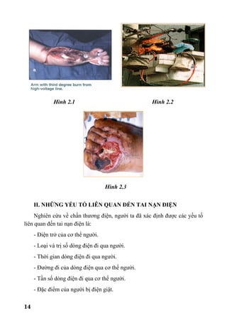 14
Hình 2.1 Hình 2.2
Hình 2.3
II. NHỮNG YẾU TỐ LIÊN QUAN ĐẾN TAI NẠN ĐIỆN
Nghiên cứu về chấn thương điện, người ta đã xác định được các yếu tố
liên quan đến tai nạn điện là:
- Điện trở của cơ thể người.
- Loại và trị số dòng điện đi qua người.
- Thời gian dòng điện đi qua người.
- Đường đi của dòng điện qua cơ thể người.
- Tần số dòng điện đi qua cơ thể người.
- Đặc điểm của người bị điện giật.
 