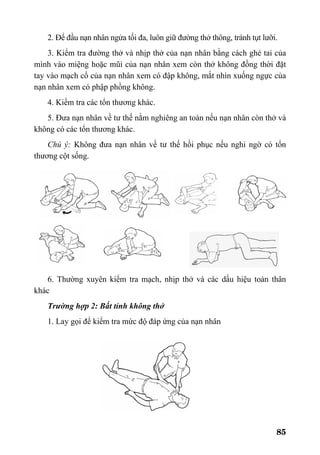 85
2. Để đầu nạn nhân ngửa tối đa, luôn giữ đường thở thông, tránh tụt lưỡi.
3. Kiểm tra đường thở và nhịp thở của nạn nhân bằng cách ghé tai của
mình vào miệng hoặc mũi của nạn nhân xem còn thở không đồng thời đặt
tay vào mạch cổ của nạn nhân xem có đập không, mắt nhìn xuống ngực của
nạn nhân xem có phập phồng không.
4. Kiểm tra các tổn thương khác.
5. Đưa nạn nhân về tư thế nằm nghiêng an toàn nếu nạn nhân còn thở và
không có các tổn thương khác.
Chú ý: Không đưa nạn nhân về tư thế hồi phục nếu nghi ngờ có tổn
thương cột sống.
6. Thường xuyên kiểm tra mạch, nhịp thở và các dấu hiệu toàn thân
khác
Trường hợp 2: Bất tỉnh không thở
1. Lay gọi để kiểm tra mức độ đáp ứng của nạn nhân
 