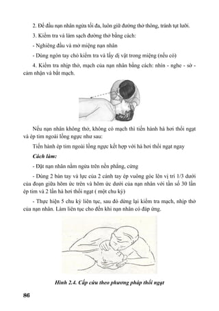 86
2. Để đầu nạn nhân ngửa tối đa, luôn giữ đường thở thông, tránh tụt lưỡi.
3. Kiểm tra và làm sạch đường thở bằng cách:
- Nghiêng đầu và mở miệng nạn nhân
- Dùng ngón tay chỏ kiểm tra và lấy dị vật trong miệng (nếu có)
4. Kiểm tra nhịp thở, mạch của nạn nhân bằng cách: nhìn - nghe - sờ -
cảm nhận và bắt mạch.
Nếu nạn nhân không thở, không có mạch thì tiến hành hà hơi thổi ngạt
và ép tim ngoài lồng ngực như sau:
Tiến hành ép tim ngoài lồng ngực kết hợp với hà hơi thổi ngạt ngay
Cách làm:
- Đặt nạn nhân nằm ngửa trên nền phẳng, cứng
- Dùng 2 bàn tay và lực của 2 cánh tay ép vuông góc lên vị trí 1/3 dưới
của đoạn giữa hõm ức trên và hõm ức dưới của nạn nhân với tần số 30 lần
ép tim và 2 lần hà hơi thổi ngạt ( một chu kỳ)
- Thực hiện 5 chu kỳ liên tục, sau đó dừng lại kiểm tra mạch, nhịp thở
của nạn nhân. Làm liên tục cho đến khi nạn nhân có đáp ứng.
Hình 2.4. Cấp cứu theo phương pháp thổi ngạt
 