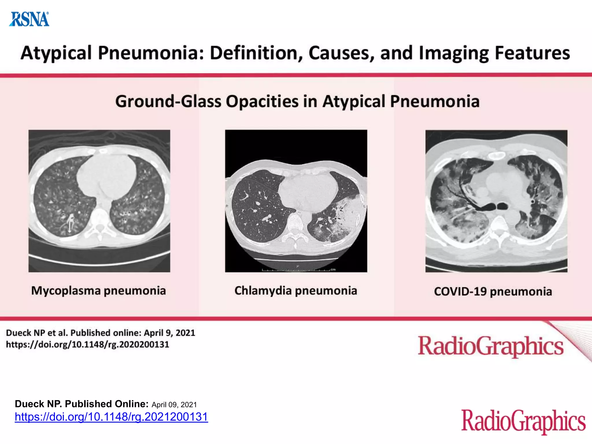 atypical pneumonia.pptx