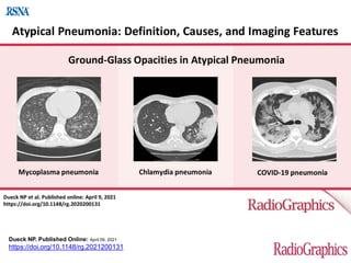 Dueck NP. Published Online: April 09, 2021
https://doi.org/10.1148/rg.2021200131
 