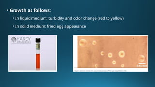 Atypical Pneumonia: Mycoplasma, Chlamydia, and Legionella – Clinical ...