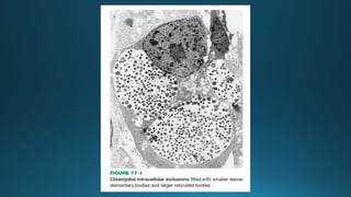 Atypical Pneumonia: Mycoplasma, Chlamydia, and Legionella – Clinical ...