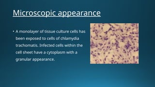 Atypical Pneumonia: Mycoplasma, Chlamydia, and Legionella – Clinical ...