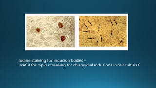Atypical Pneumonia: Mycoplasma, Chlamydia, and Legionella – Clinical ...