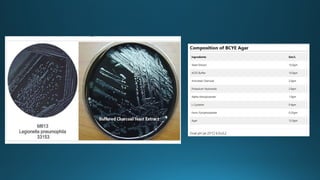 Atypical Pneumonia: Mycoplasma, Chlamydia, and Legionella – Clinical ...