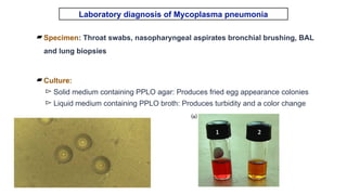 Comprehensive Overview of Atypical Pneumonia and Its Pathogens | PPTX