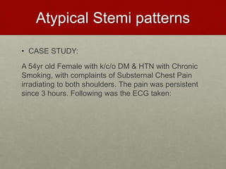 Atypical Stemi patterns
• CASE STUDY:
A 54yr old Female with k/c/o DM & HTN with Chronic
Smoking, with complaints of Substernal Chest Pain
irradiating to both shoulders. The pain was persistent
since 3 hours. Following was the ECG taken:
 