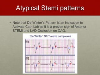 Atypical Stemi patterns
• Note that De-Winter’s Pattern is an indication to
Activate Cath Lab as it is a proven sign of Anterior
STEMI and LAD Occlusion on CAG.
 