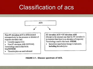Classification of acs
 
