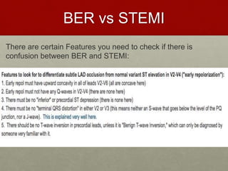 BER vs STEMI
There are certain Features you need to check if there is
confusion between BER and STEMI:
 