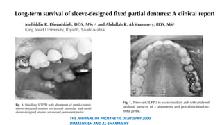 THE JOURNAL OF PROSTHETIC DENTISTRY 2000
DIMASHKIEH AND AL-SHAMMERY
 