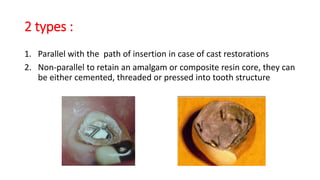 2 types :
1. Parallel with the path of insertion in case of cast restorations
2. Non-parallel to retain an amalgam or composite resin core, they can
be either cemented, threaded or pressed into tooth structure
 