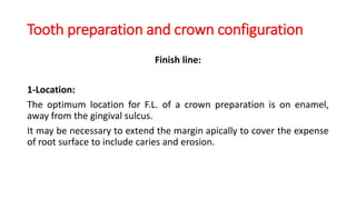 Tooth preparation and crown configuration
Finish line:
1-Location:
The optimum location for F.L. of a crown preparation is on enamel,
away from the gingival sulcus.
It may be necessary to extend the margin apically to cover the expense
of root surface to include caries and erosion.
 