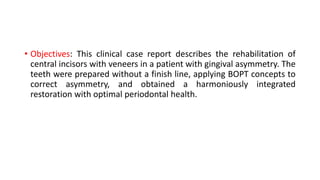 • Objectives: This clinical case report describes the rehabilitation of
central incisors with veneers in a patient with gingival asymmetry. The
teeth were prepared without a finish line, applying BOPT concepts to
correct asymmetry, and obtained a harmoniously integrated
restoration with optimal periodontal health.
 