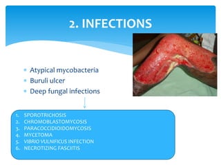  Atypical mycobacteria
 Buruli ulcer
 Deep fungal infections
12
2. INFECTIONS
1. SPOROTRICHOSIS
2. CHROMOBLASTOMYCOSIS
3. PARACOCCIDIOIDOMYCOSIS
4. MYCETOMA
5. VIBRIO VULNIFICUS INFECTION
6. NECROTIZING FASCIITIS
 