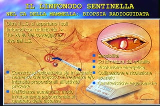 Oltre il L.S. si asportano i soli linfonodi con radiattività  > 10- 20 % del conteggio ex vivo del L.S. Converte la radioattività sia in segnale numerico che acustico di frequenza e/o intensità proporzionali all’attività presente L’efficienza aumenta in modo inversamente proporzionale al quadrato della distanza Sensibilità Schermatura del cristallo Risoluzione energetica Collimazione e risoluzione spaziale Caratteristiche ergonomiche IL LINFONODO SENTINELLA NEL CA DELLA MAMMELLA: BIOPSIA RADIOGUIDATA  